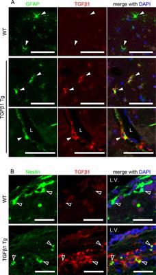 Excessive Production of Transforming Growth Factor β1 Causes Mural Cell Depletion From Cerebral Small Vessels